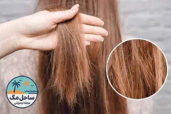 خشکی مو؛ علل، روش‌های پیشگیری و درمان موهای خشک و آسیب‌دیده